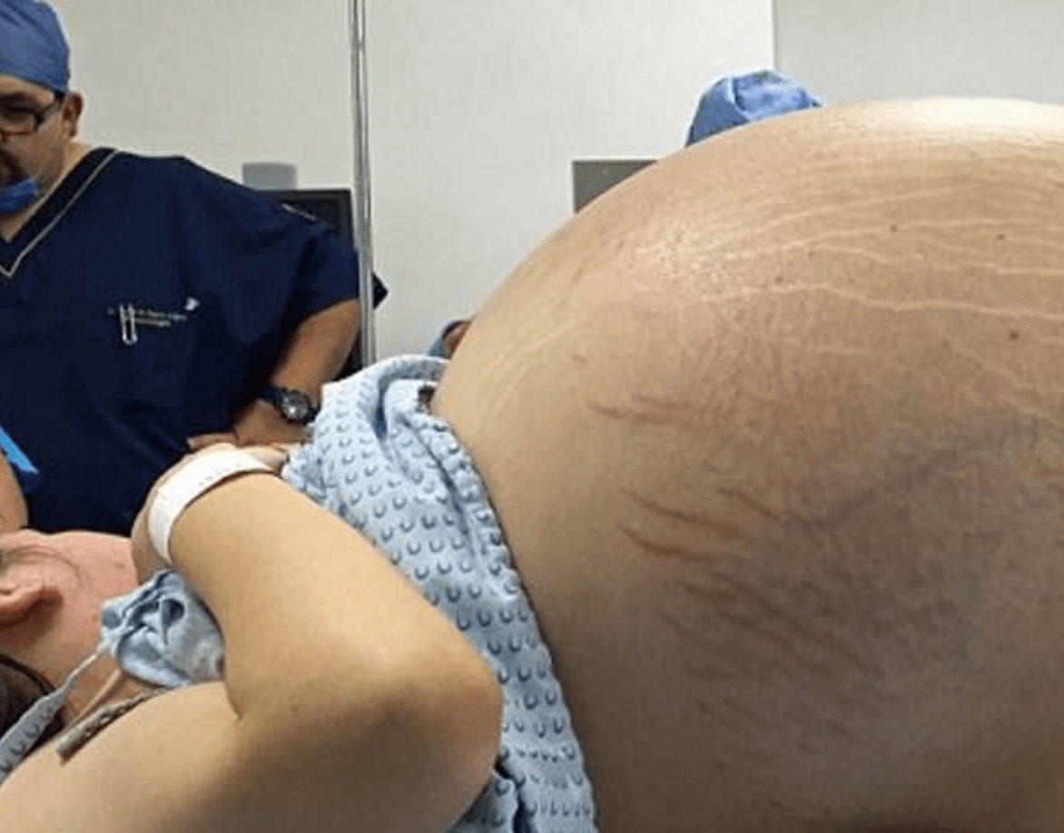 Deje Embarazada A Una Mujer Que No Amo