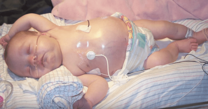 Medico Observa Que Algo Extrano Crece En La Panza De Una Bebe Lo Que Descubre Luego De Ver A Su Hermanita Gemela Lo Deja En Shock Familias Medico Observa Que Algo Extrano Crece En La Panza De Una Bebe Lo Que Descubre Luego De Ver A Su Hermanita Gemela Lo Deja En Shock Familias