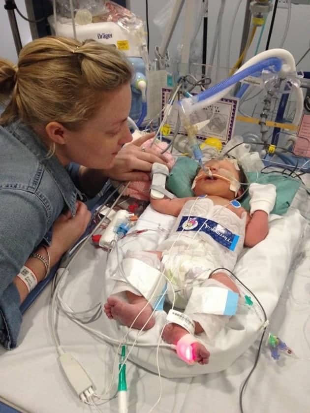 Nacio Muerta A Los 5 Meses De Gestacion Pero Una Decision Inesperada De Los Medicos Y Un Milagro Salvaron Su Vida Familias Nacio Muerta A Los 5 Meses De Gestacion Pero Una Decision Inesperada De Los Medicos Y Un Milagro Salvaron Su Vida Familias