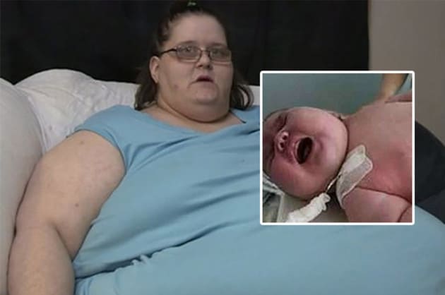 Una Mujer De 270 Kilos Dio A Luz Al Bebe Mas Grande Del Mundo La Ciencia Lo Llamo Un Milagro Su Peso Y Tamano Dejo A Los Medicos Perplejos Familias